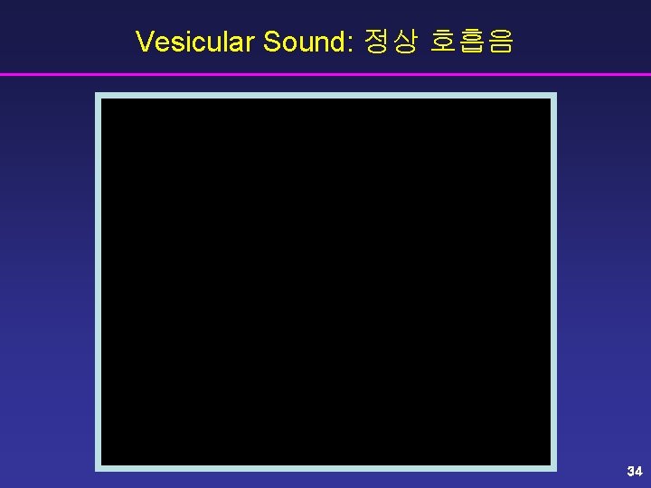 Vesicular Sound: 정상 호흡음 34 