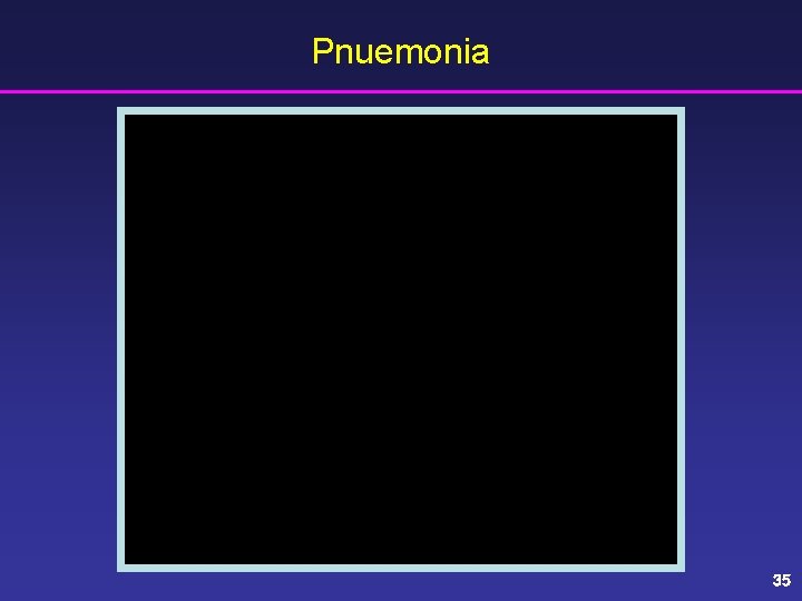 Pnuemonia 35 