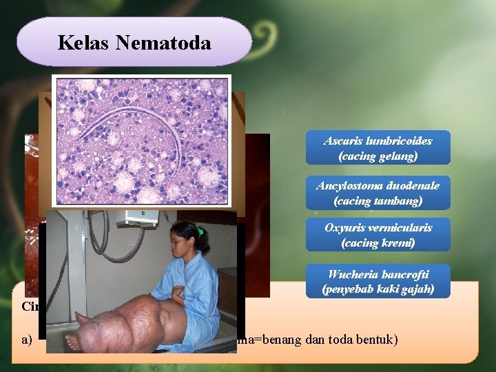 Kelas Nematoda Ascaris lumbricoides (cacing gelang) Ancylostoma duodenale (cacing tambang) Oxyuris vermicularis (cacing kremi)