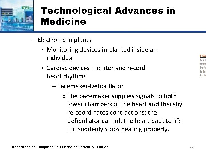 Technological Advances in Medicine – Electronic implants • Monitoring devices implanted inside an individual