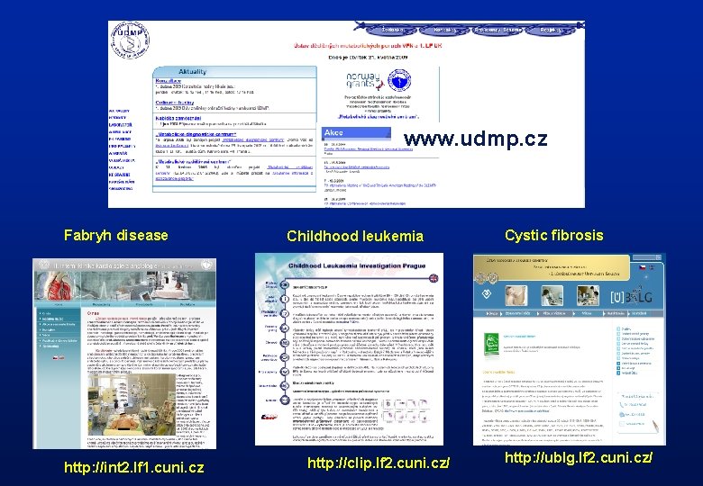 www. udmp. cz Fabryh disease http: //int 2. lf 1. cuni. cz Childhood leukemia