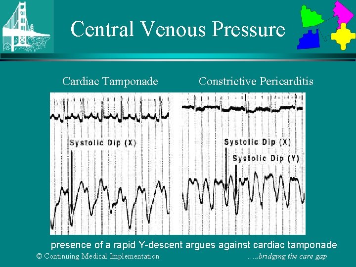 Central Venous Pressure Cardiac Tamponade Constrictive Pericarditis presence of a rapid Y-descent argues against