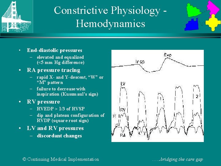 Constrictive Physiology Hemodynamics • End-diastolic pressures – elevated and equalized (<5 mm Hg difference)