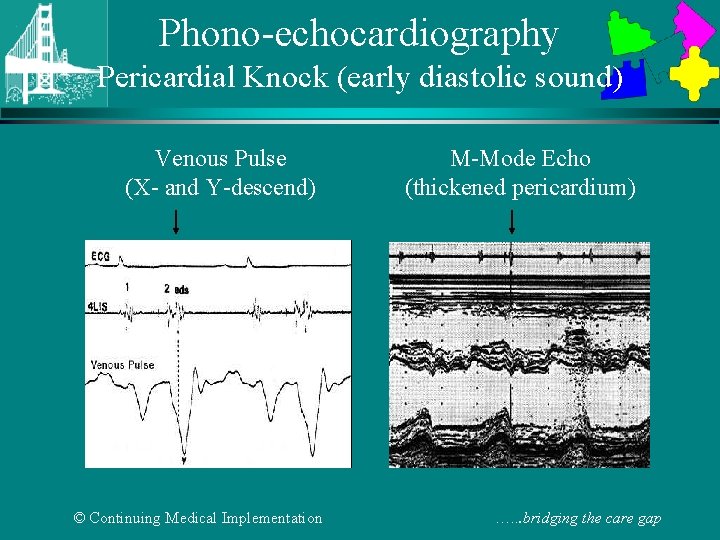 Phono-echocardiography Pericardial Knock (early diastolic sound) Venous Pulse (X- and Y-descend) © Continuing Medical