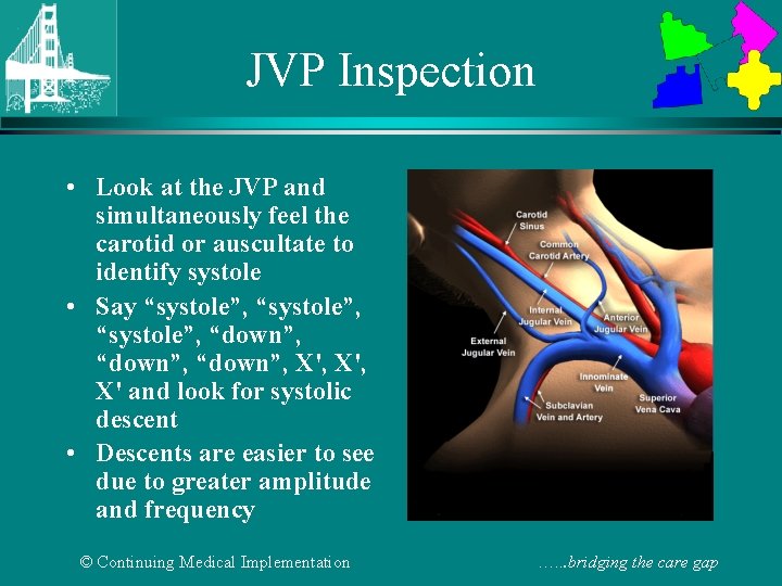 JVP Inspection • Look at the JVP and simultaneously feel the carotid or auscultate