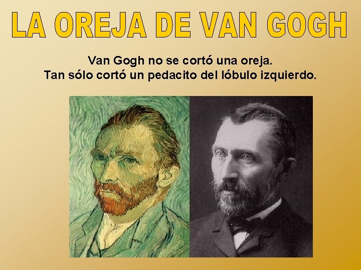Van Gogh no se cortó una oreja. Tan sólo cortó un pedacito del lóbulo
