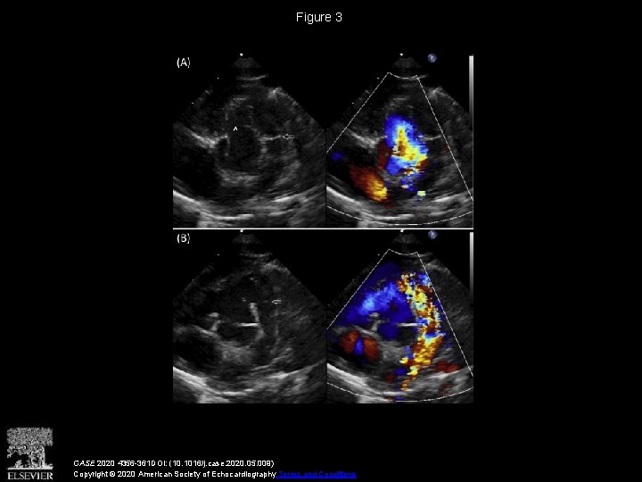 Figure 3 CASE 2020 4356 -361 DOI: (10. 1016/j. case. 2020. 05. 009) Copyright