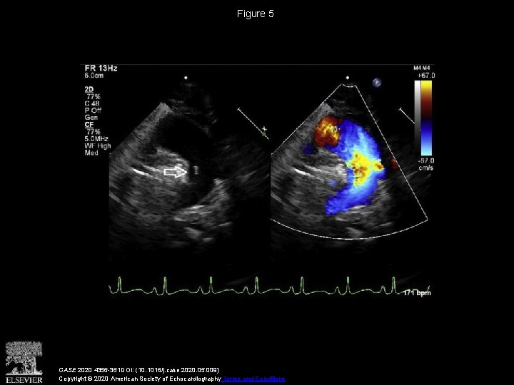 Figure 5 CASE 2020 4356 -361 DOI: (10. 1016/j. case. 2020. 05. 009) Copyright