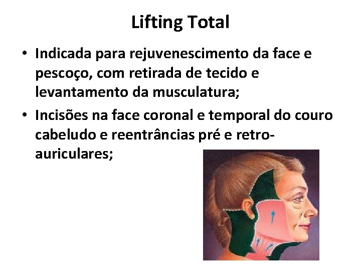 Lifting Total • Indicada para rejuvenescimento da face e pescoço, com retirada de tecido