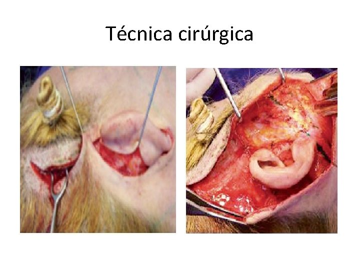 Técnica cirúrgica 