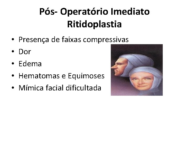 Pós- Operatório Imediato Ritidoplastia • • • Presença de faixas compressivas Dor Edema Hematomas