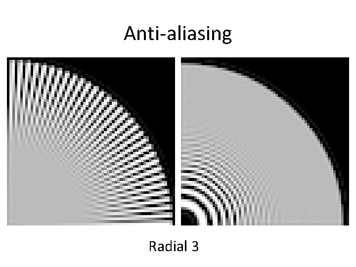 Anti-aliasing Radial 3 
