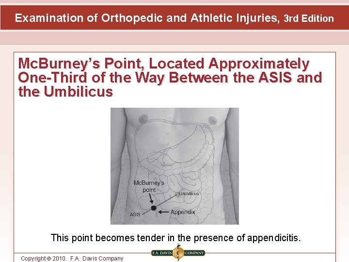 Examination of Orthopedic and Athletic Injuries, 3 rd Edition Mc. Burney’s Point, Located Approximately