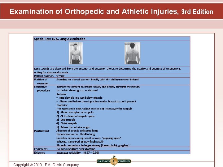 Examination of Orthopedic and Athletic Injuries, 3 rd Edition Copyright © 2010. F. A.