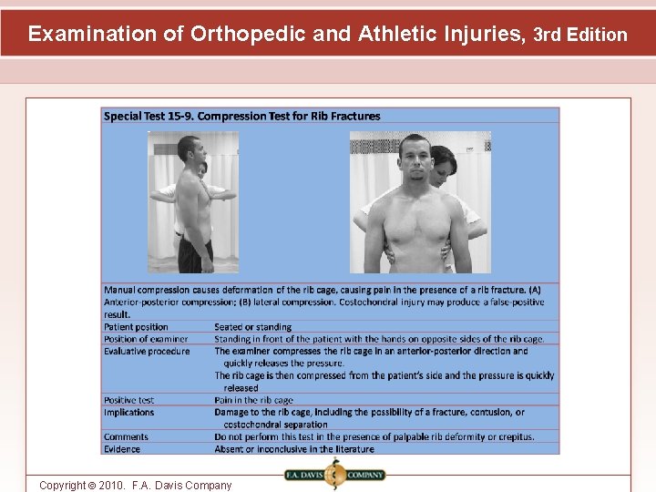 Examination of Orthopedic and Athletic Injuries, 3 rd Edition Copyright © 2010. F. A.
