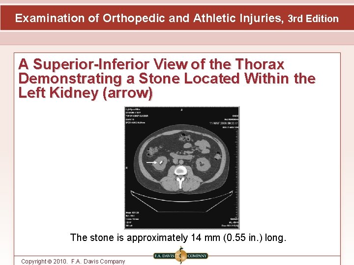 Examination of Orthopedic and Athletic Injuries, 3 rd Edition A Superior-Inferior View of the