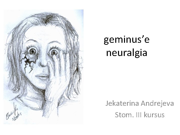 geminus’e neuralgia Jekaterina Andrejeva Stom. III kursus 