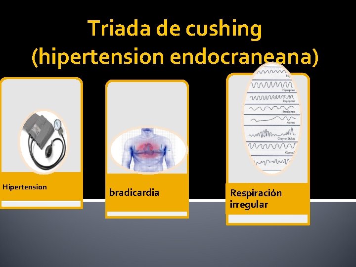 Triada de cushing (hipertension endocraneana) Hipertension bradicardia Respiración irregular 