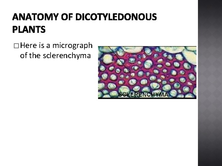 ANATOMY OF DICOTYLEDONOUS PLANTS � Here is a micrograph of the sclerenchyma 