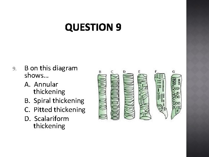 QUESTION 9 9. B on this diagram shows… A. Annular thickening B. Spiral thickening