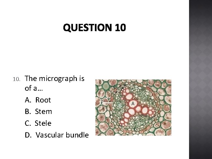 QUESTION 10 10. The micrograph is of a… A. Root B. Stem C. Stele
