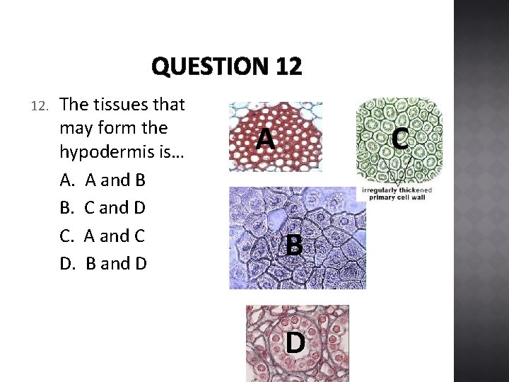 QUESTION 12 12. The tissues that may form the hypodermis is… A. A and
