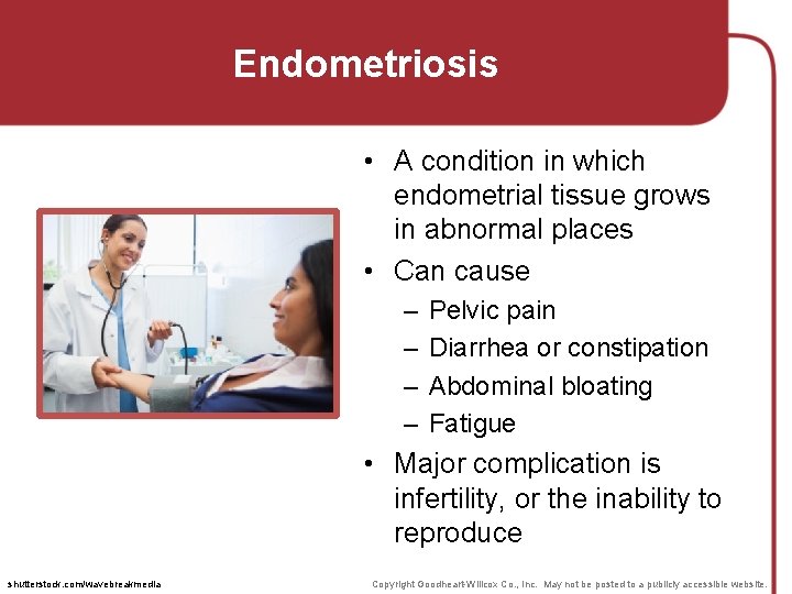 Endometriosis • A condition in which endometrial tissue grows in abnormal places • Can