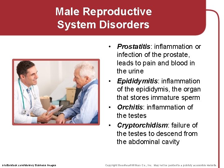 Male Reproductive System Disorders • Prostatitis: inflammation or infection of the prostate, leads to