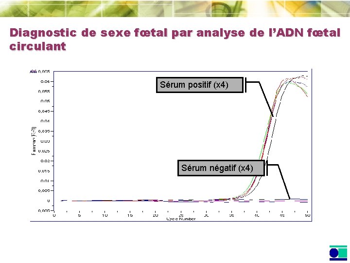 Diagnostic de sexe fœtal par analyse de l’ADN fœtal circulant Sérum positif (x 4)