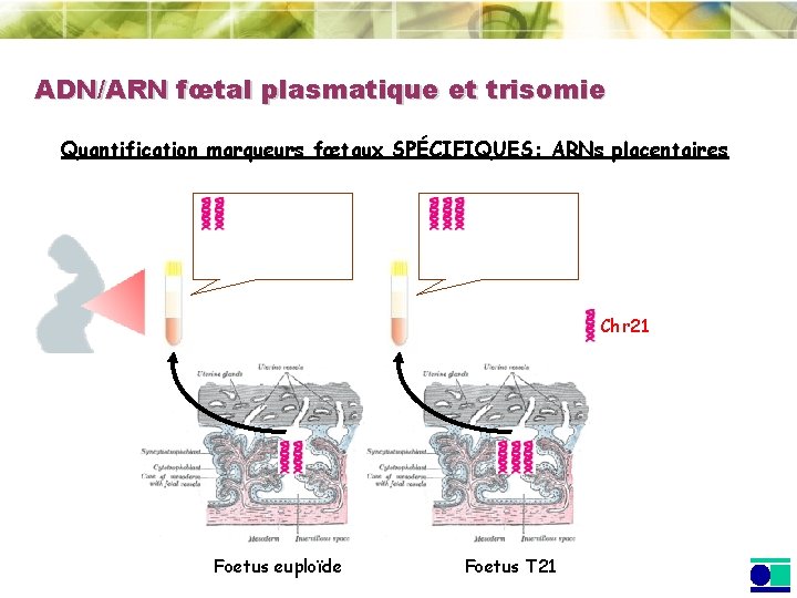 ADN/ARN fœtal plasmatique et trisomie Quantification marqueurs fœtaux SPÉCIFIQUES: ARNs placentaires Chr 21 Foetus