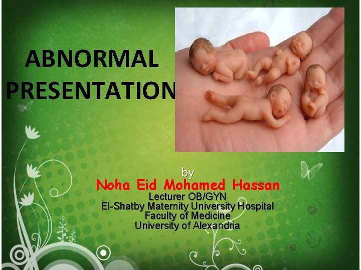 ABNORMAL PRESENTATION by Noha Eid Mohamed Hassan Lecturer OB/GYN El-Shatby Maternity University Hospital Faculty