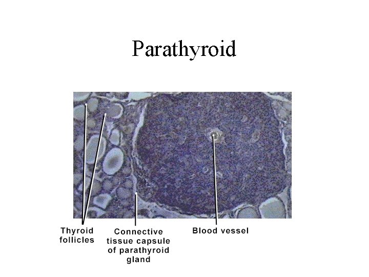 Parathyroid 