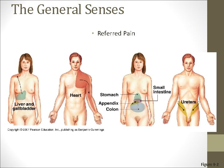 The General Senses • Referred Pain Figure 9 -2 