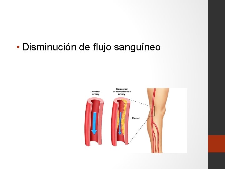  • Disminución de flujo sanguíneo 