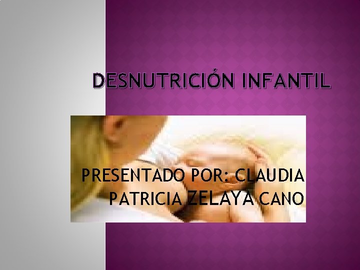 DESNUTRICIÓN INFANTIL PRESENTADO POR: CLAUDIA PATRICIA ZELAYA CANO 