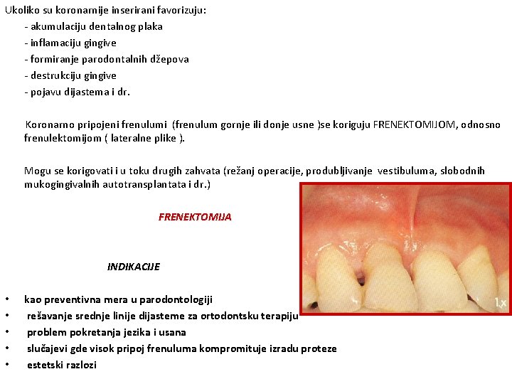 Ukoliko su koronarnije inserirani favorizuju: - akumulaciju dentalnog plaka - inflamaciju gingive - formiranje