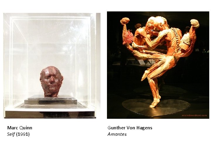 Marc Quinn Self (1991) Gunther Von Hagens Amantes 