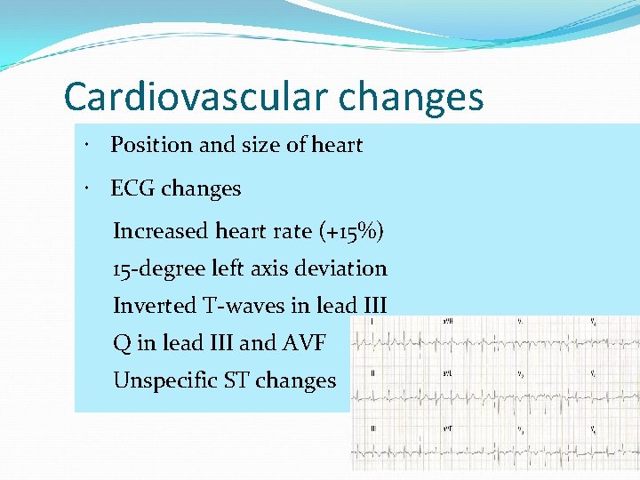 Cardiovascular changes Position and size of heart ECG changes Increased heart rate (+15%) 15