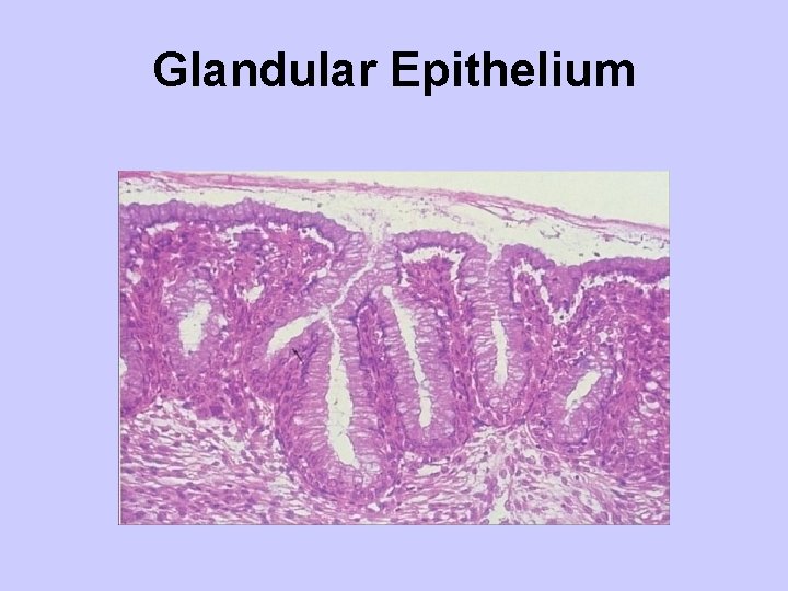Glandular Epithelium 