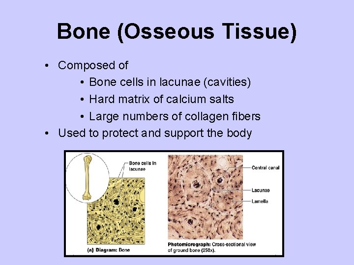 Bone (Osseous Tissue) • Composed of • Bone cells in lacunae (cavities) • Hard