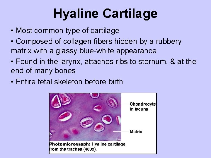 Hyaline Cartilage • Most common type of cartilage • Composed of collagen fibers hidden