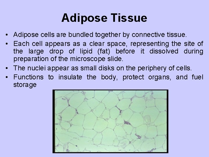 Adipose Tissue • Adipose cells are bundled together by connective tissue. • Each cell