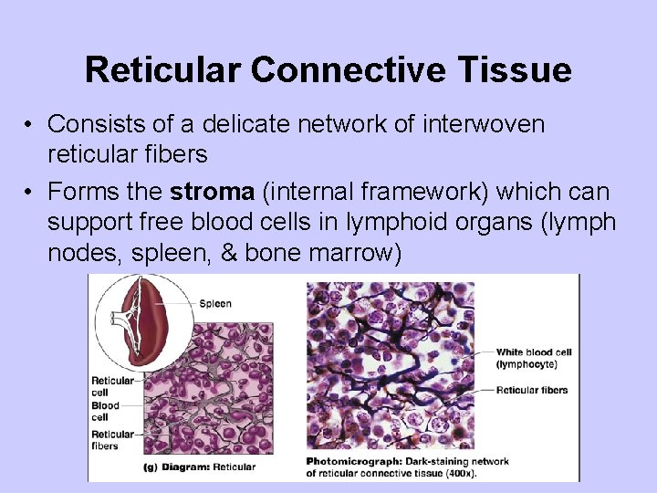 Reticular Connective Tissue • Consists of a delicate network of interwoven reticular fibers •