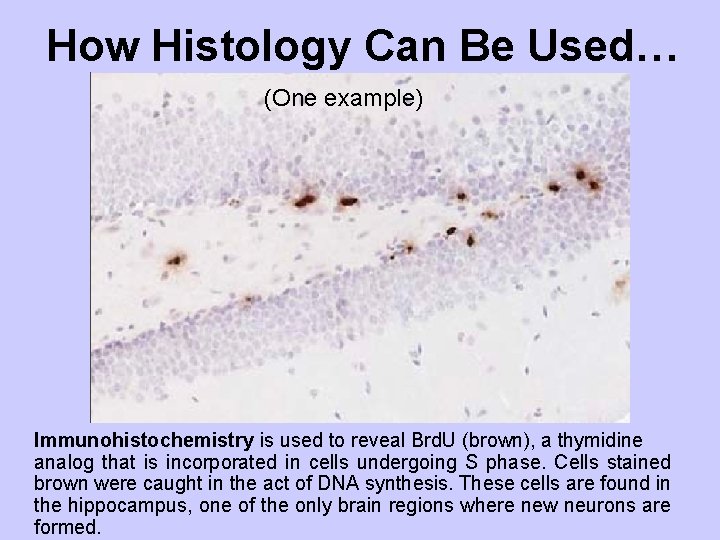 How Histology Can Be Used… (One example) Immunohistochemistry is used to reveal Brd. U