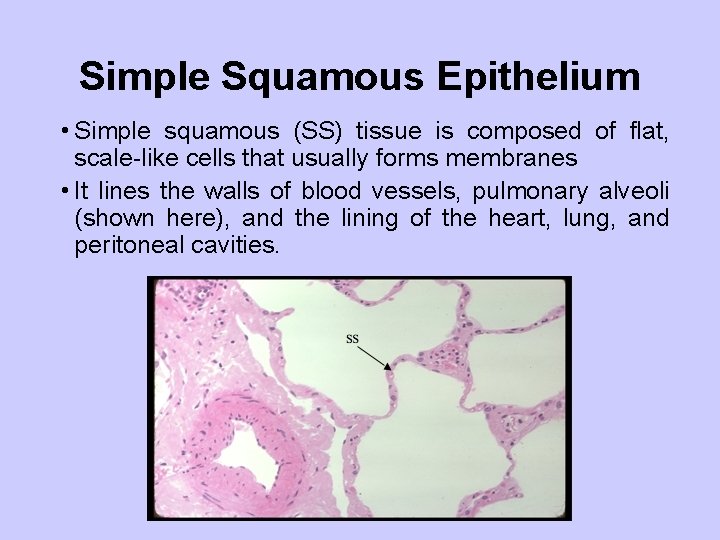 Simple Squamous Epithelium • Simple squamous (SS) tissue is composed of flat, scale-like cells