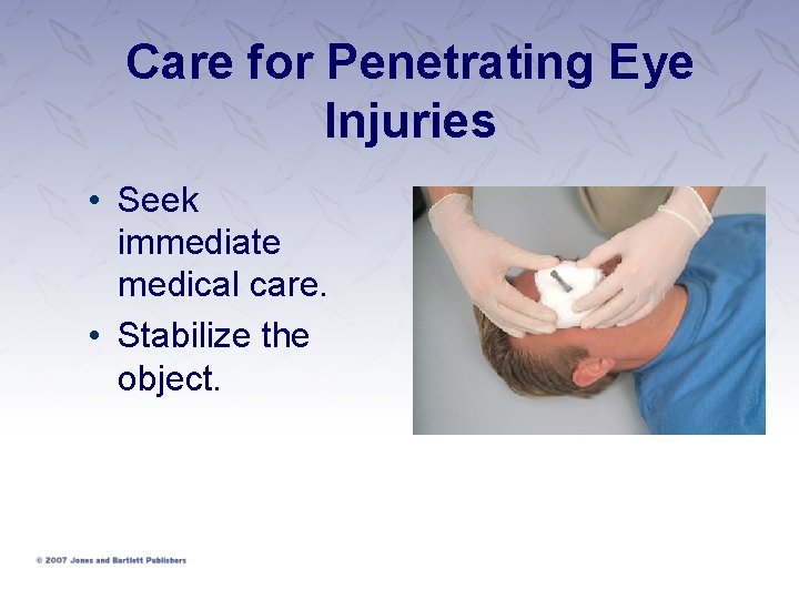 Care for Penetrating Eye Injuries • Seek immediate medical care. • Stabilize the object.