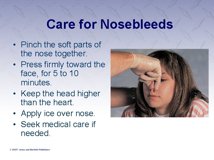 Care for Nosebleeds • Pinch the soft parts of the nose together. • Press