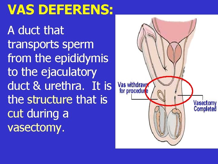 VAS DEFERENS: A duct that transports sperm from the epididymis to the ejaculatory duct