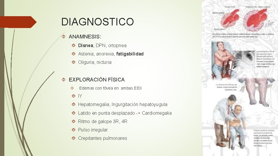 DIAGNOSTICO ANAMNESIS: Disnea, DPN, ortopnea Astenia, anorexia, fatigabilidad Oliguria, nicturia EXPLORACIÓN FÍSICA Edemas con