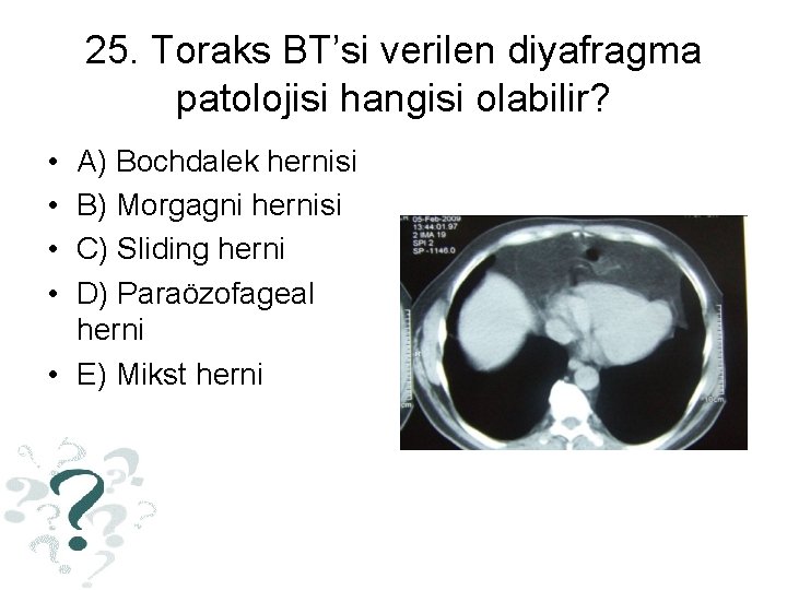 25. Toraks BT’si verilen diyafragma patolojisi hangisi olabilir? • • A) Bochdalek hernisi B)